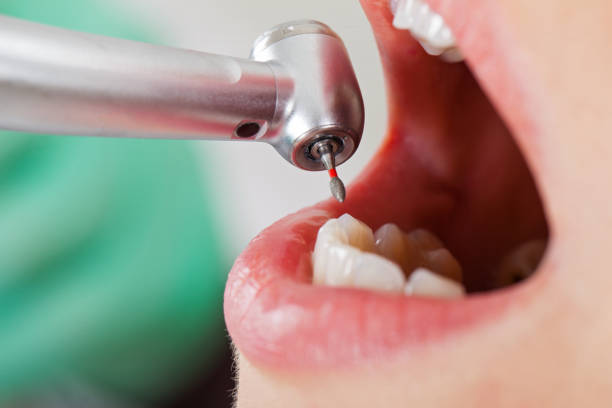Best Emergency Treatment for Jaw Pain or Injury in Rawls Springs, MS